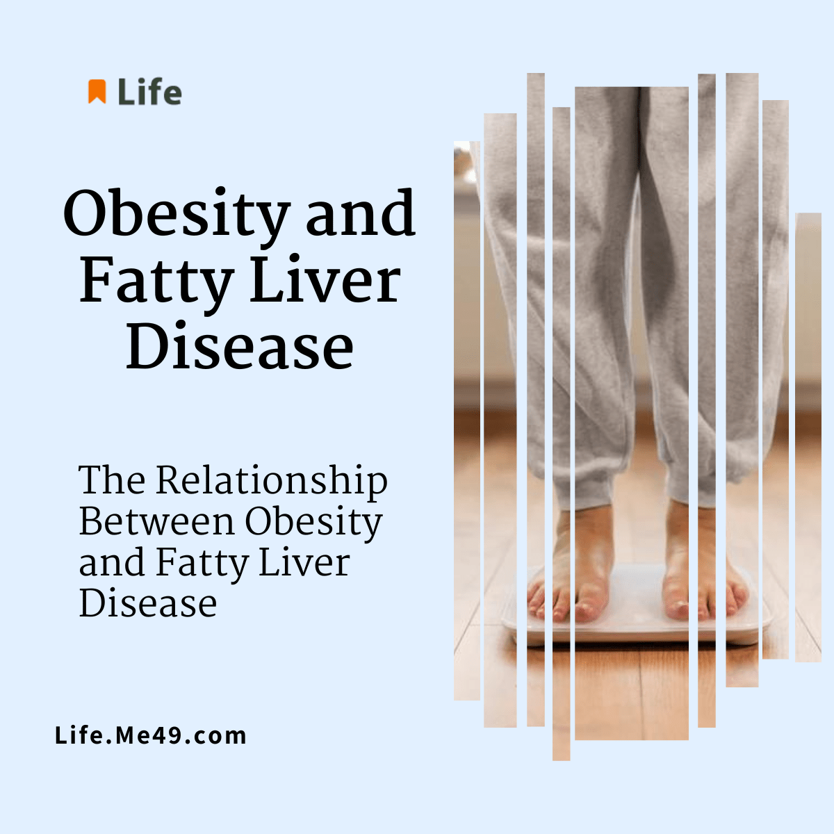 Obesity and Fatty Liver Disease